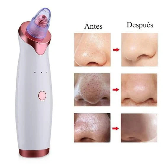 PoreClean Pro® – Miles en Dominicanos  ya lo usan para decirle adiós a los puntos negros y espinillas 😱💨