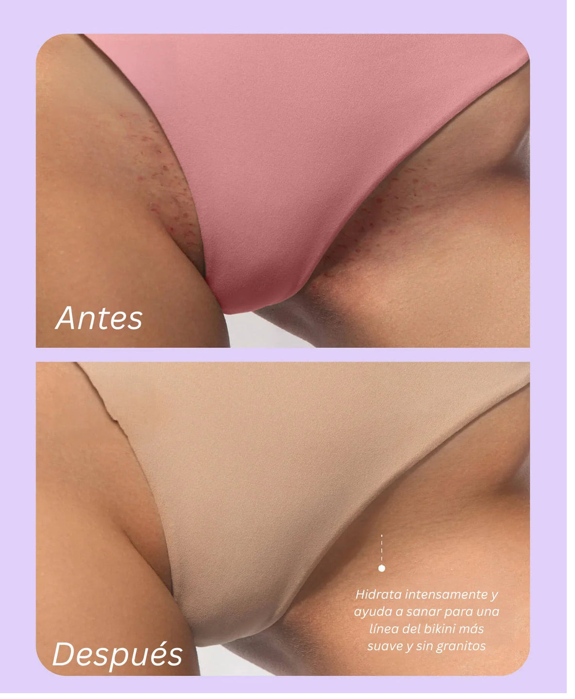 Aceite Íntimo 100% Natural – Suavidad, Hidratación y Prevención de Irritación -ENVIO GRATIS
