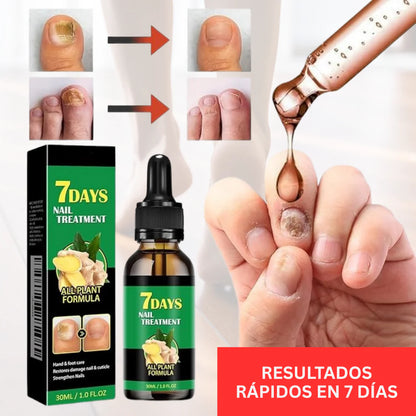 Uñas Libres de Hongos en 7 Días + Corta Uñas Gratis - Tratamiento Natural y Efectivo