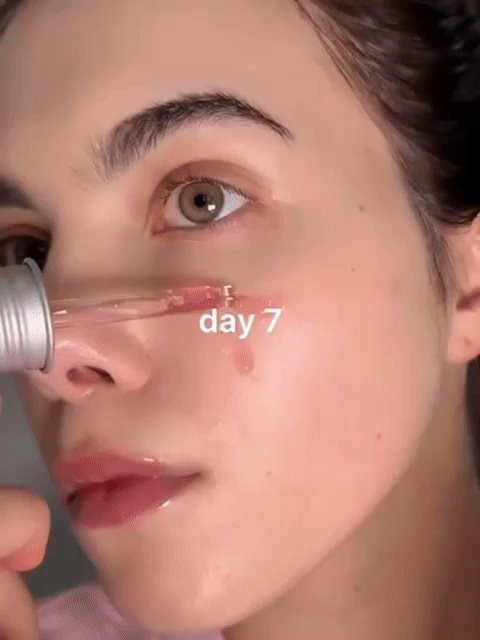 KOREAN GLASS SKIN SERUM -🎯 PIEL SIN ACNÉ NI MANCHAS EN 14 DÍAS